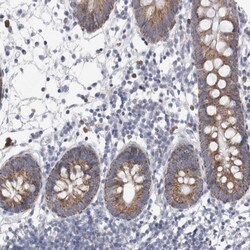 AGMAT Antibody, Novus Biologicals:Antibodies:Primary Antibodies